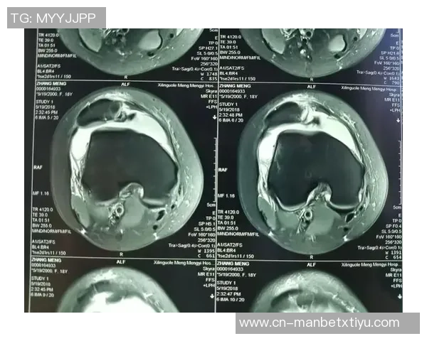约维奇重摔受伤退场X光检查结果无异常明日将进行MRI检查评估伤情